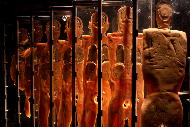 Secciones del cuerpo humano con corte frontal hechos con láser y preservados en placas.
