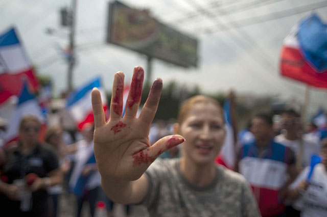 Una manifestante muestra sangre de una herida que se hizo en el cerco de púas que la PNC ha colocado desde el 9 de marzo para bloquear el acceso al centro de conteo del TSE. Foto AFP/José Cabezas