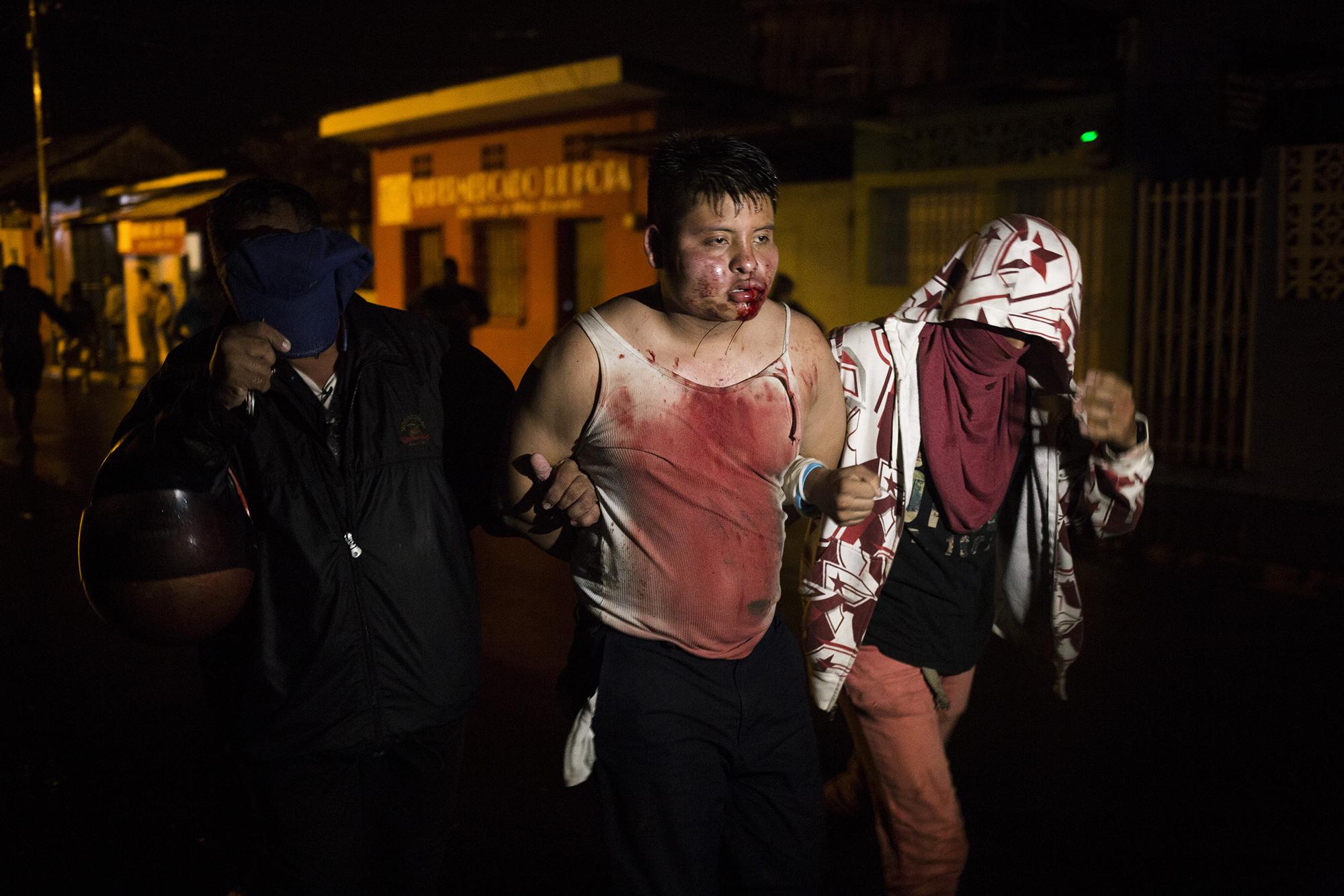 La noche del martes 5 de junio, las turbas capturaron a este agente de la policía, en el desvío del municipio de Nindirí, que colinda con la ciudad de Masaya. Luego lo entregaron a la iglesia San Miguel. El sacerdote Edwin Román lo llevó a la estación de la policía un día después.