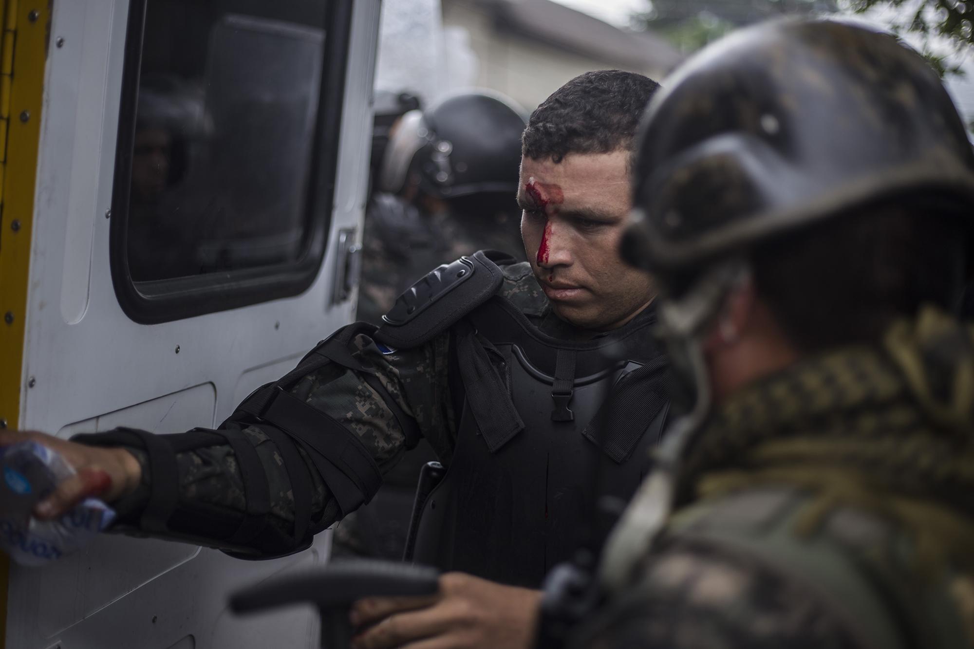 Un miembro de la Policía Millitar fue herido durante las protestas. Una piedra lanzada por los estudiantes impactó en su frente. El agente fue trasladado a un hospital para recibir atención. Foto: Víctor Peña.