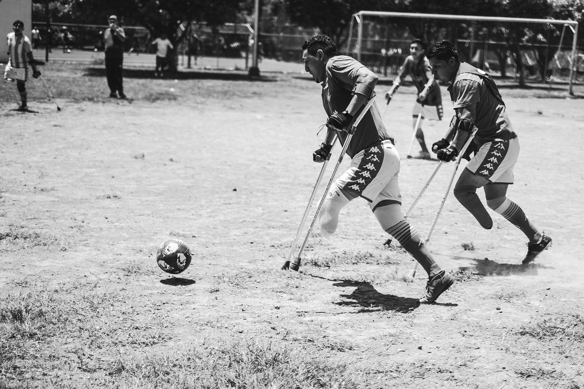 Practicar fútbol en El Salvador es precario, si se trata de fútbol de amputados lo es aún más. No hay canchas habilitadas para que los deportistas puedan correr con los bastones. Debido a eso, las lesiones en los brazos son comunes. 