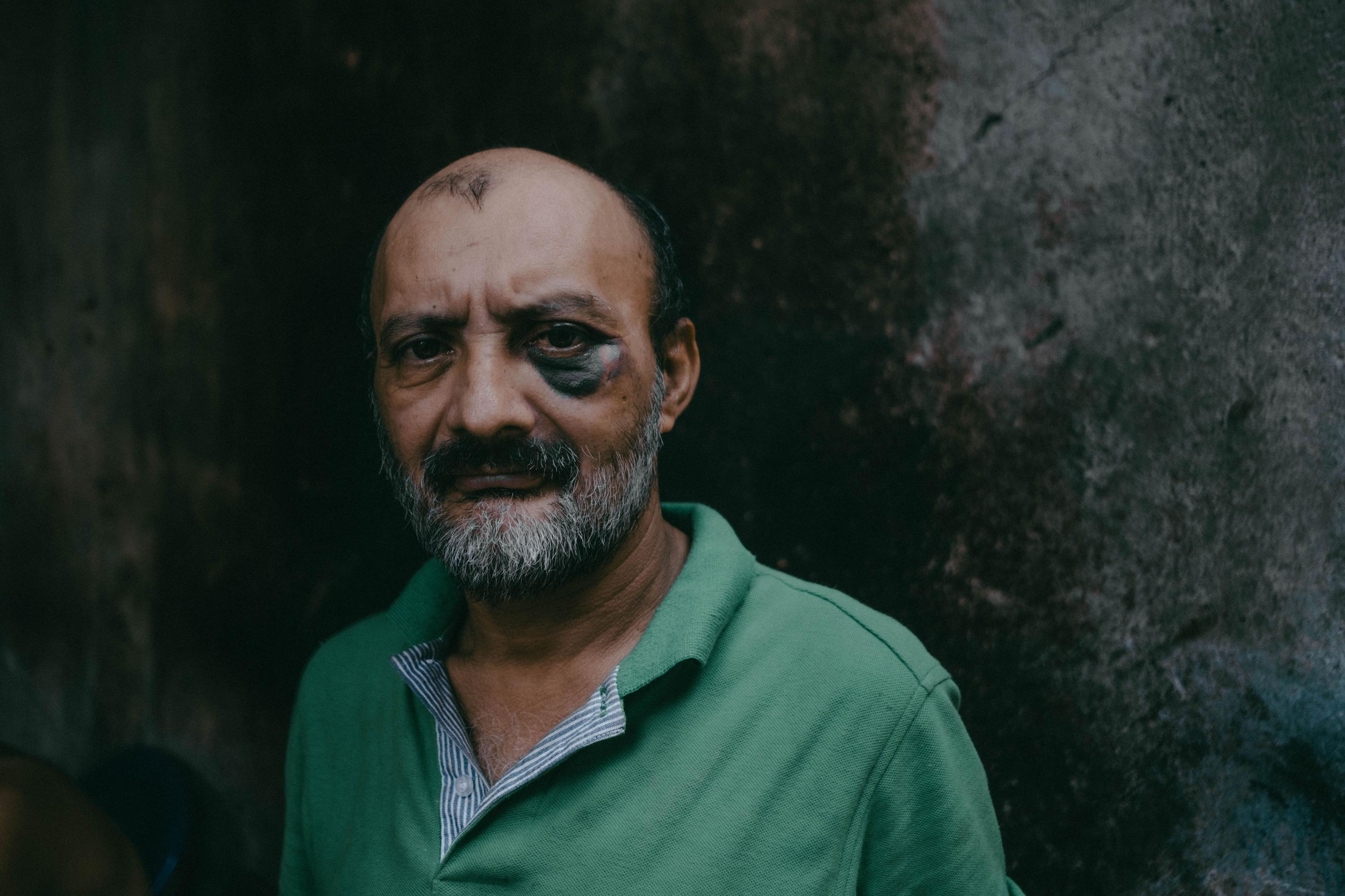 Óscar Sorto was beaten up while drinking heavily with a group of people. He, too, began drinking in adolescence, like the majority of patients at El Brit. He turned himself in just over a week ago, and he intends on passing through the three-month process to be able to leave rehab.