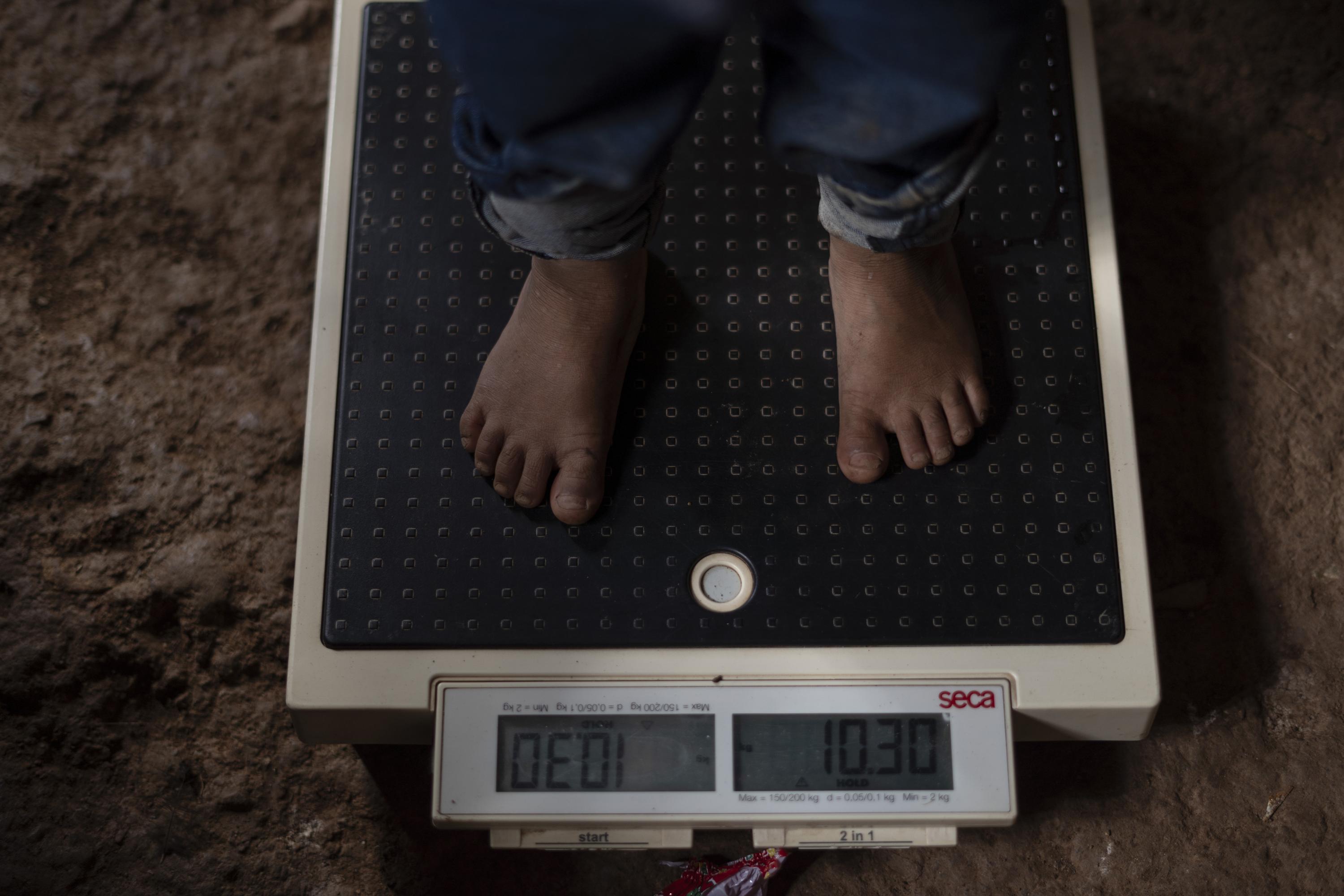 About 600 people live in La Ceiba Talquezal. One hundred and fifty, or 25 percent of the total population, are children under the age of five. Health worker Israel Ramírez says that, since assuming his position in 2013, they have recorded the deaths of 18 children in the community. The three most recent deaths were in April 2024, according to figures from the community health commission, which attributed their deaths to anemia. The Ministry of Health and Action Against Hunger also recorded three deaths of children during the first months of the year, attributing two of the deaths to dehydration and prolonged diarrhea without medical attention, and one to respiratory problems. In August 2024, Action Against Hunger conducted a nutritional study of 91 children in the community. The data are worrying: 78 percent of the children were chronically malnourished and ten children were at risk of acute malnutrition.