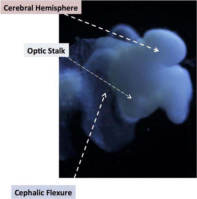 Esquema del organoide de laboratorio en donde se señalan las estructuras identificadas del cerebro desarrollado in vitro por el profesor Rene Anand. AFP PHOTO/ OHIO STATE UNIVERSITY/
