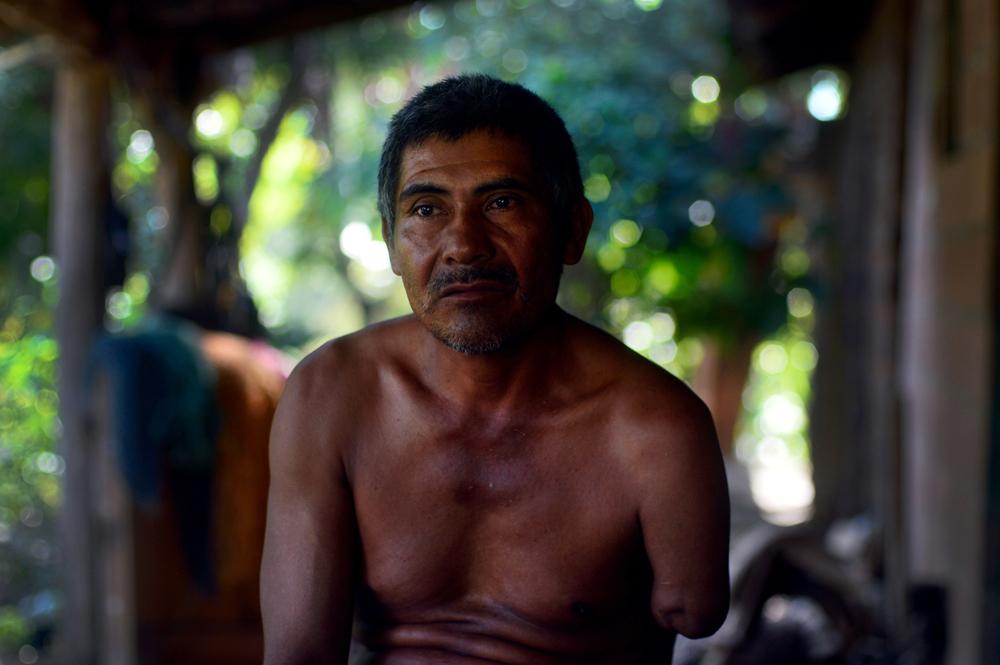 Reynaldo Hernández tiene 49 años. Se incorporó a la guerrilla a los 15 años, en 1982, en el norte del departamento de Morazán. Una ráfaga de ametralladora M60 le cortó el brazo izquierdo durante un enfrentamiento el 11 de noviembre de 1982, en la ciudad de San Miguel. Atilio era su seudónimo de guerra. / Foto El Faro: Víctor Peña