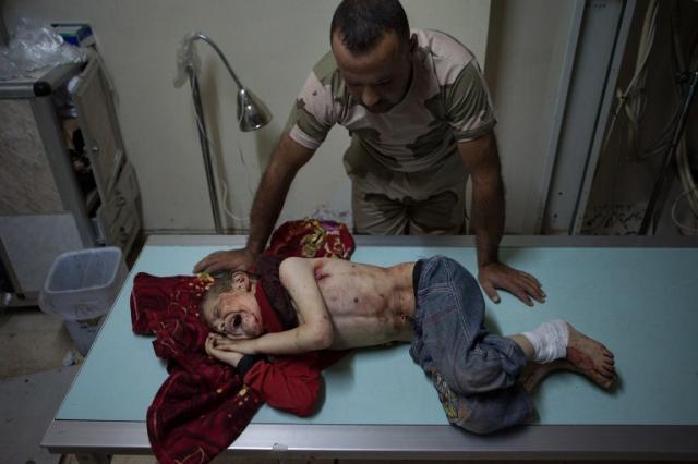 Un combatiente rebelde observa a un niño de siete años, herido en julio de 2013 junto a otros miembros de su familia por la explosión de un proyectil en la ciudad de Al-Bara.﻿ Foto archivo El Faro.