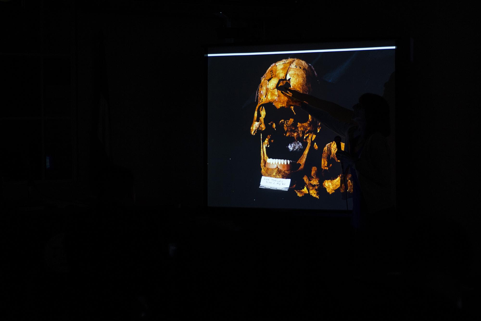 La antropóloga forense Patricia Bernardi muestra un cráneo con impacto de bala encontrado en las exhumaciones en El Mozote. Foto de El Faro: Víctor Peña.
