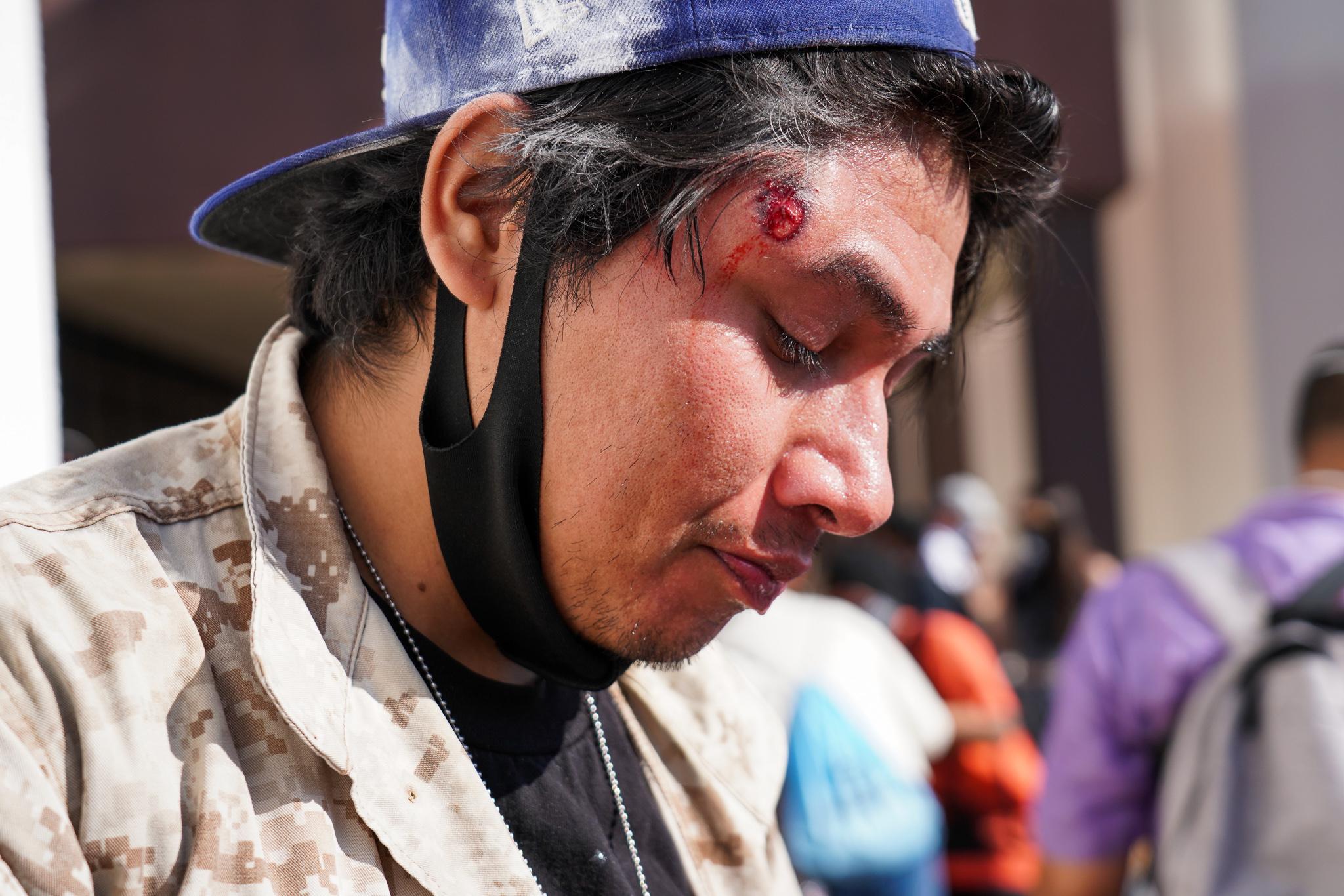 Marine Veteran Devin Cejas was injured in the forehead by a projectile shot by L.A. County Sheriff deputies outside the Compton Sheriff Station. Photo: Francisco Lozano
