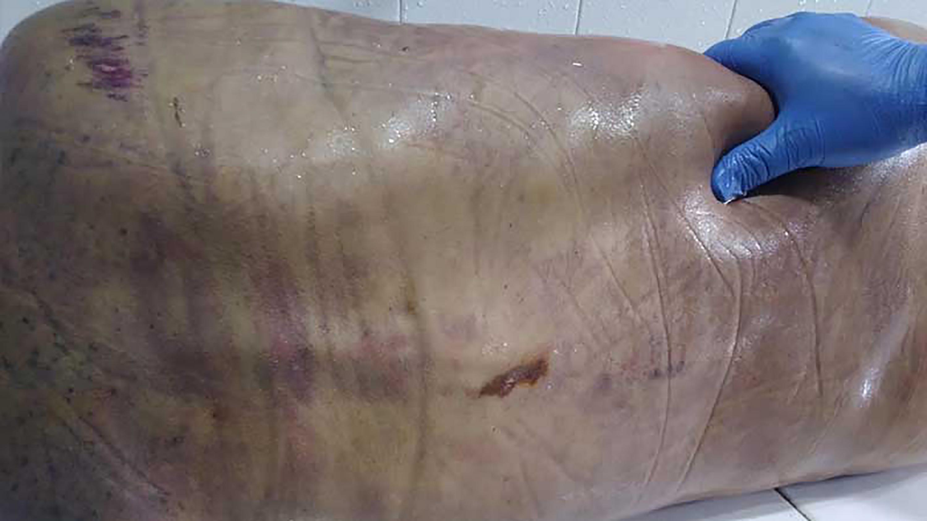 The body of Marco Tulio Castillo Reyes, a 38-year-old cab driver, showed signs of the beatings he received in Izalco and Quezaltepeque prisons. The family photographed the body to document the condition it was in when they received it from medical examiner’s office. Photo El Faro