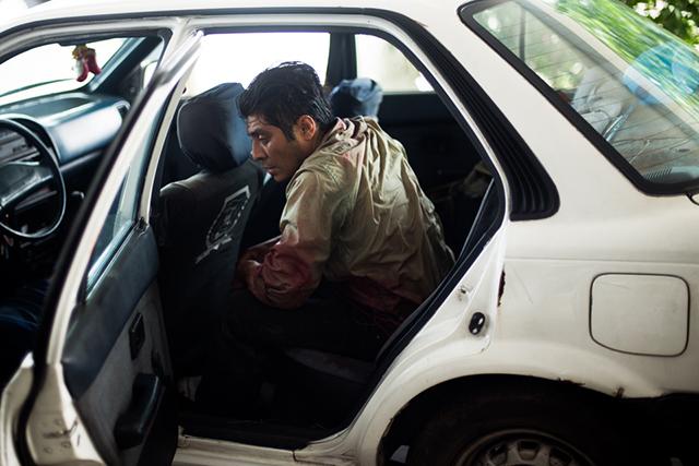 Felipe Guardado, espera a que ser auxiliado por el personal de hospital Santa Teresa, Zacatecoluca, La Paz. Foto: Fred Ramos