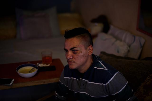 Alex Peña relata como fue golpeado por los agentes de la PNC de la subdelegación de Ciudad Delgado, San Salvador. Foto: Fred Ramos